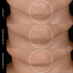 Lancome Coffret Rénergie Coffret Pour Femme -Kapao Boutique coffret genifique serum 4